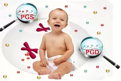 第三代试管婴儿技术--PGD（胚胎植入前遗传基因诊断）
