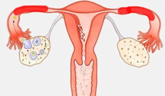 输卵管阻塞可以借助试管婴儿技术生育后代吗？