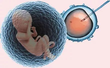 个胚胎移植细节决定试管婴儿成功率"