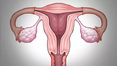 输卵管常用的检查方法有哪些？