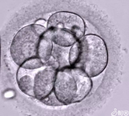 三代试管婴儿的胚胎等级